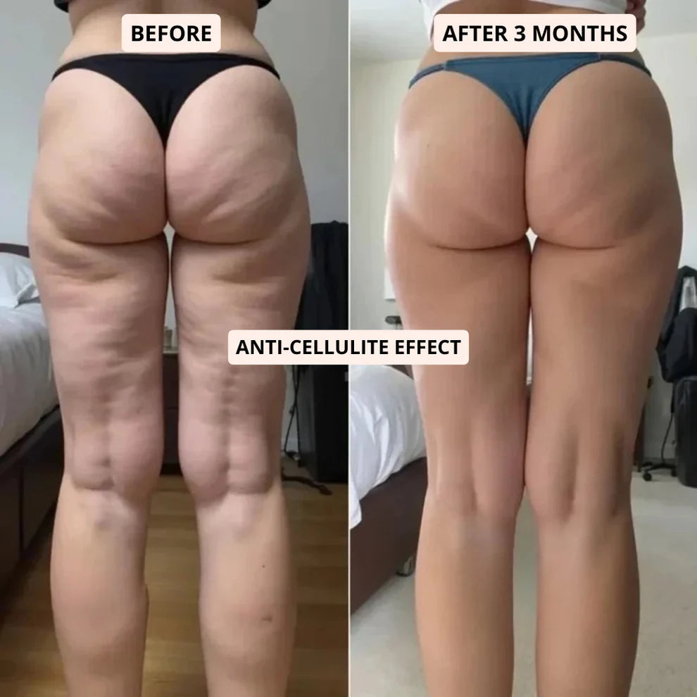 Sculptiqq | 3D Metabolic Booster Leggingss